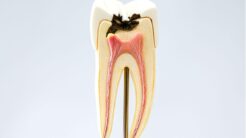 When is the Right Time to Save a Tooth?